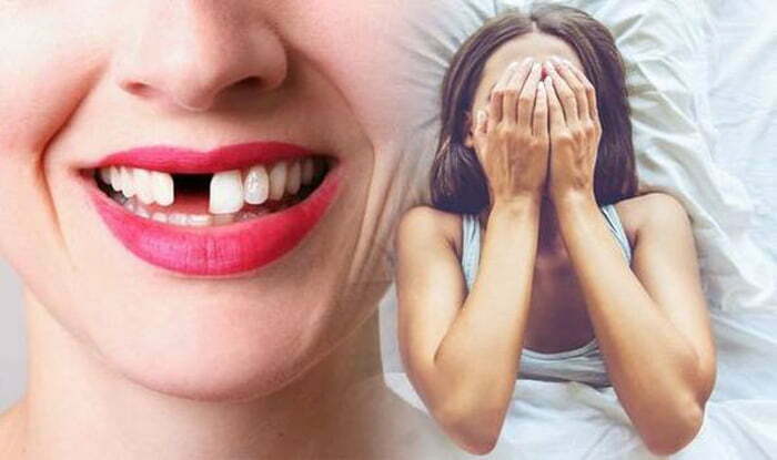 Phụ nữ rụng răng sẽ cho con số 03, 52, 85